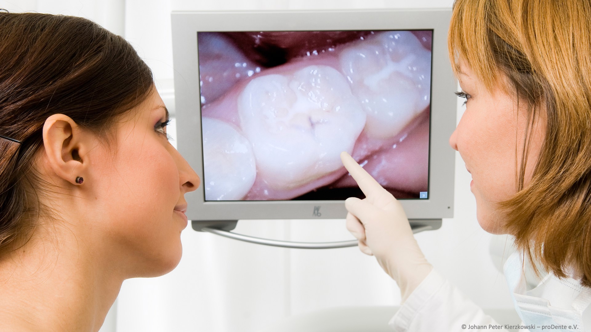 Intraorale Kamera in der Zahnarztpraxis Dr. Ayfer Akkaya-Gottschling in Oberursel